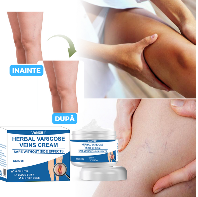 Cremă naturală împotriva varicelor și vergeturilor